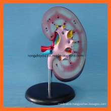 Popular Medical Anatomical Teaching Kidney Model